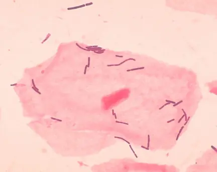 microbiota