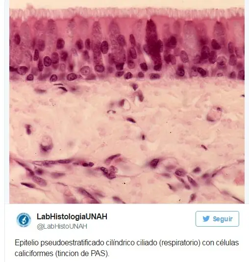 estornudos