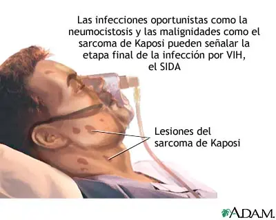 enfermedades