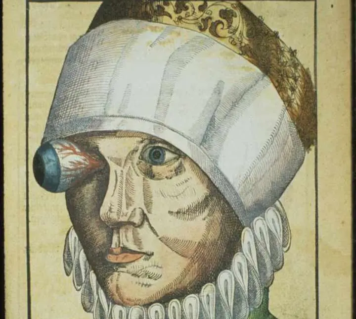 Ophthalmodouleia, un tratado de Oftalmología del siglo XVI