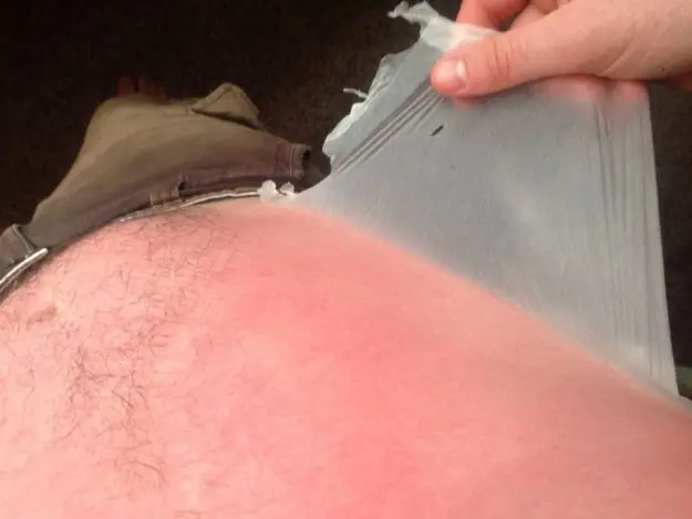 Se va el verano, quedan los dolobus