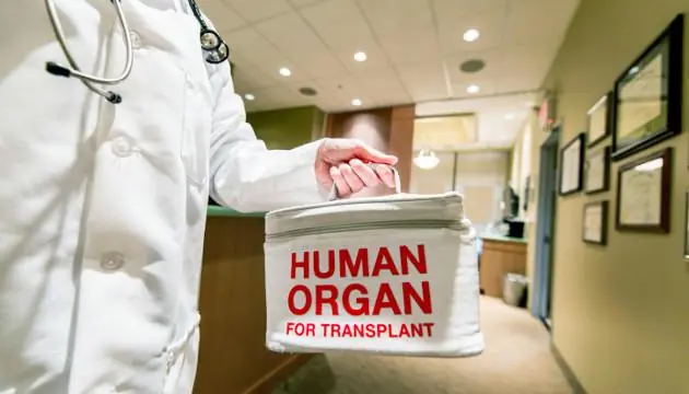 donacion de organos