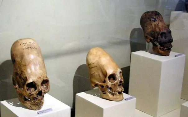 Como eran en realidad los Anunnaki ?