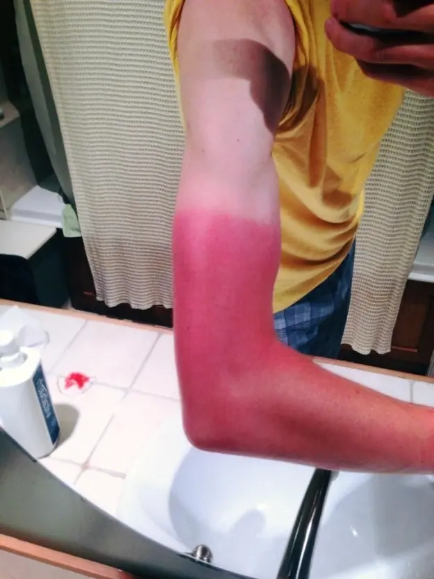 bronceado