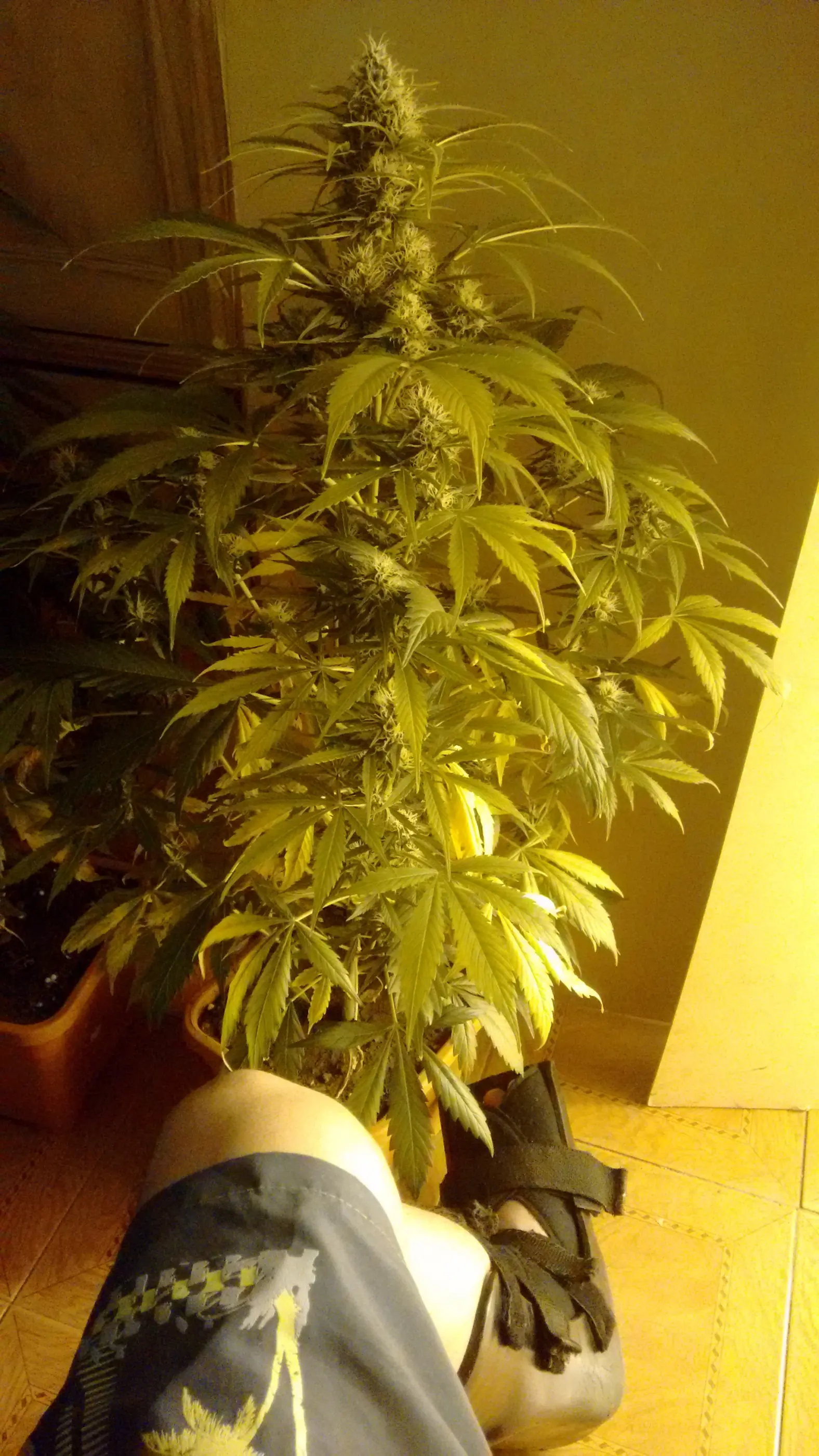 Esguince de tobillo:Tratamiento