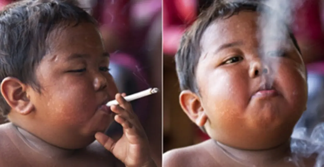 ¿Recuerdas al niño que fumaba 40 cigarrillos diarios?