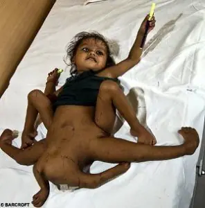 deformacion humana