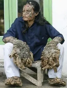enfermedades