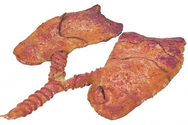 respiratorio