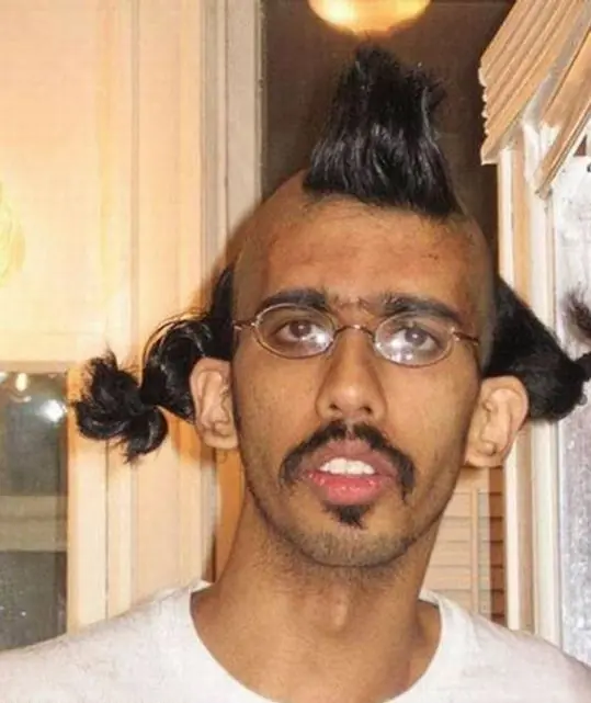 pelo