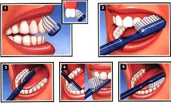 dientes
