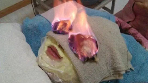 Un salón de belleza en Japón tiene unos extraños tratamie