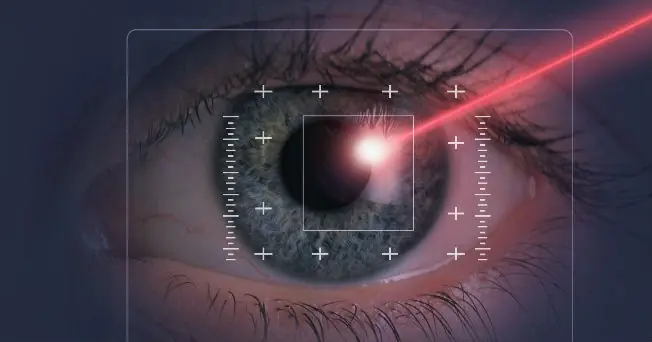 Perdida de la vision