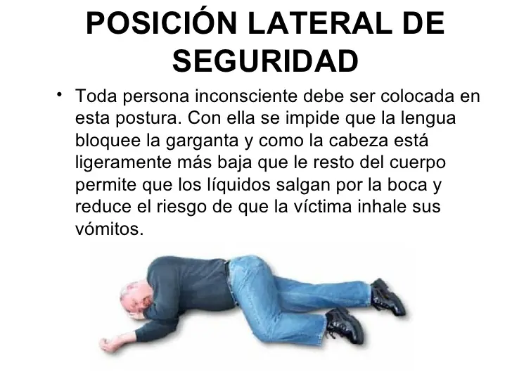 epilepsia
