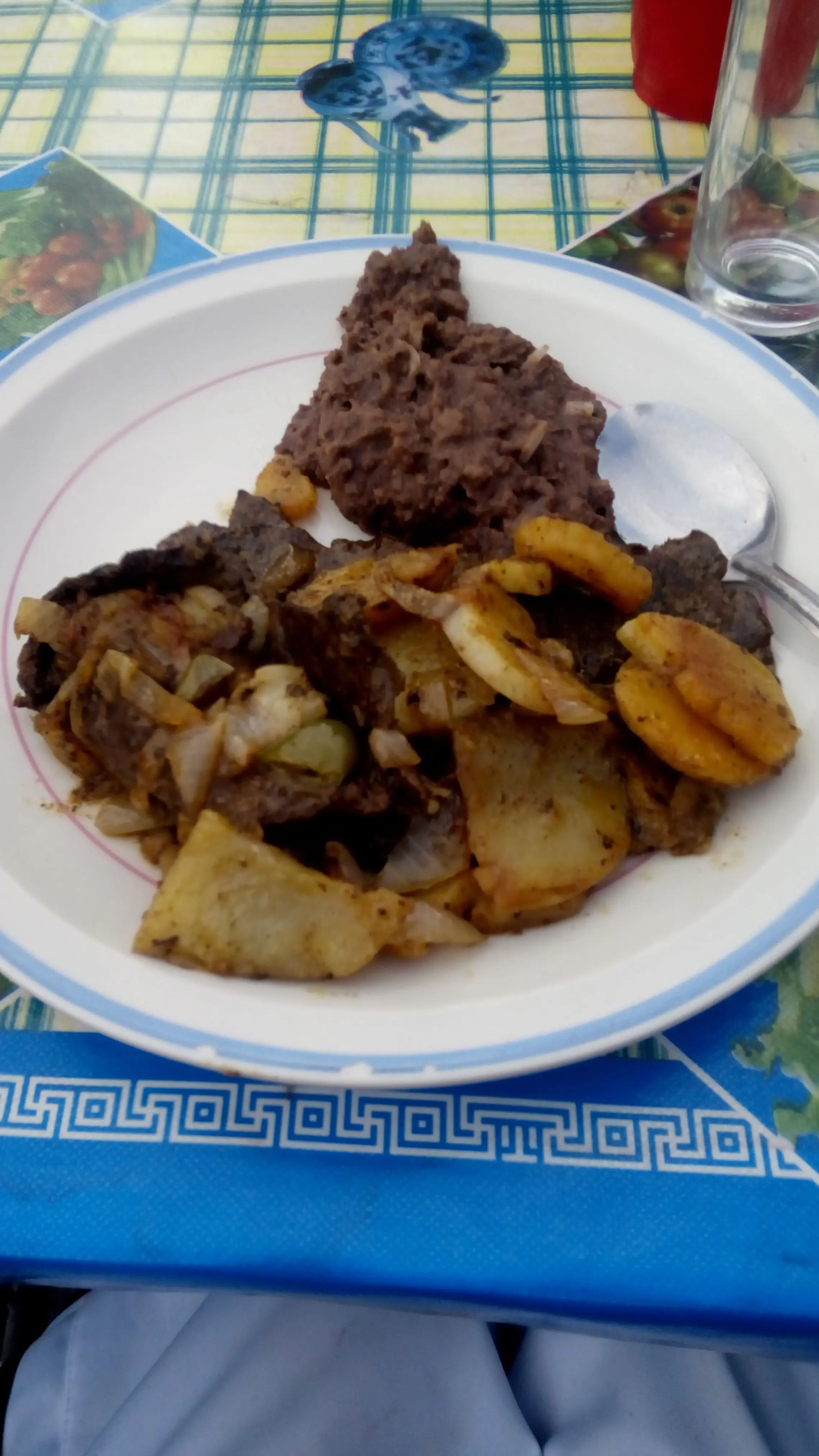 higado encebollado