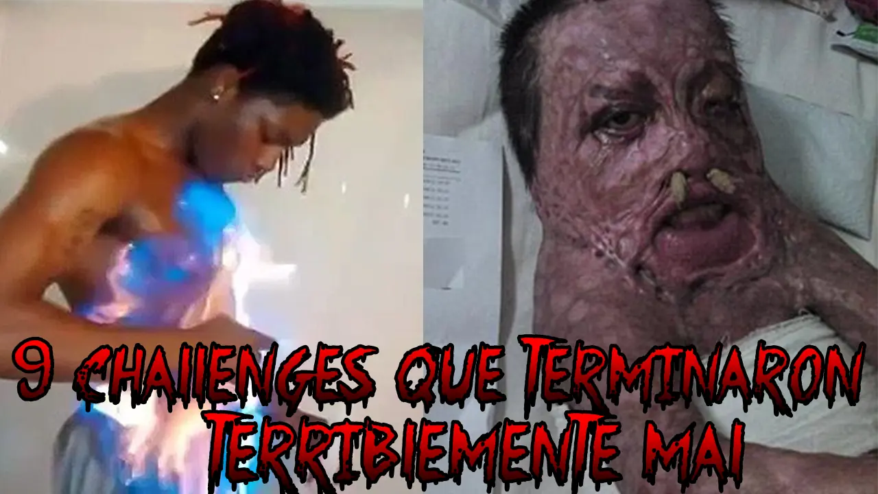 Retos de internet que salieron mal¿Meterse vodka por el ano?