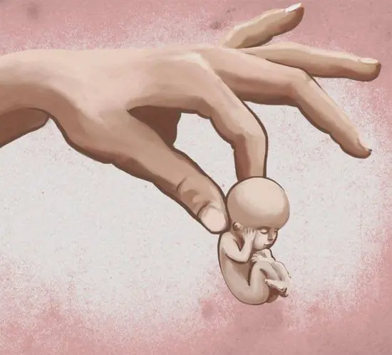 aborto