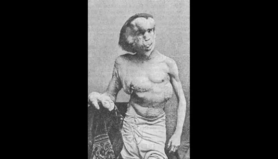 Fenomenos
