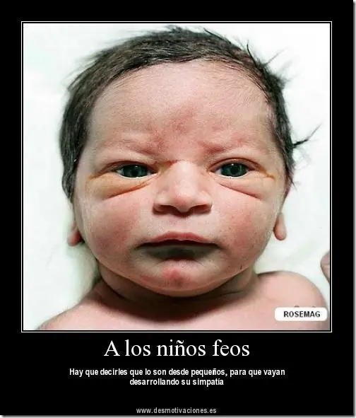 historia de terror: los mongoloides.