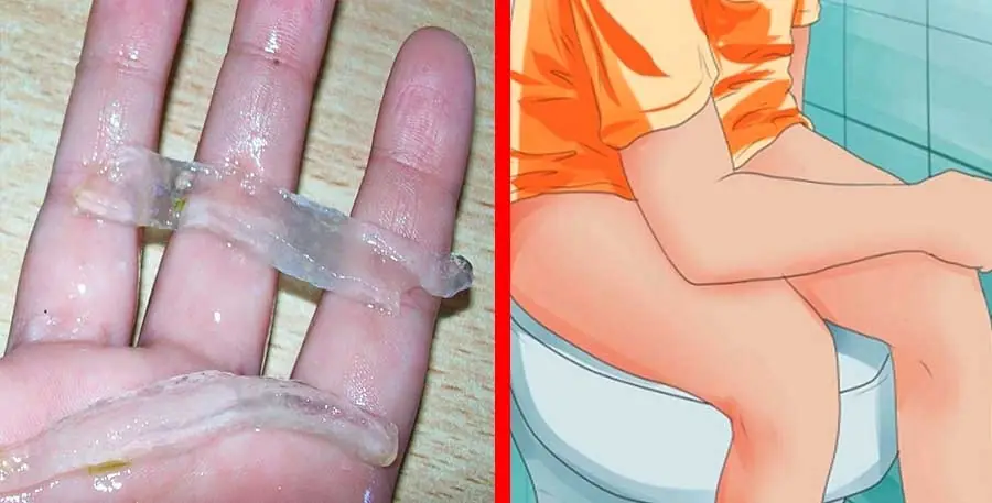 Este producto es la cura definitiva de las hemorroides