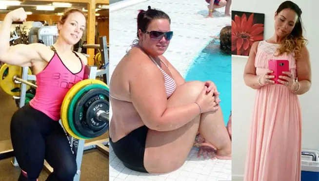 Una mujer obesa pierde 80 kilos
