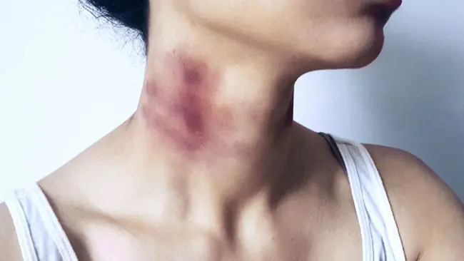 Razones con las que las adolescentes justifican maltrato