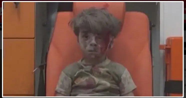 Desgarradora foto de nene ensangrentado el horror en Siria