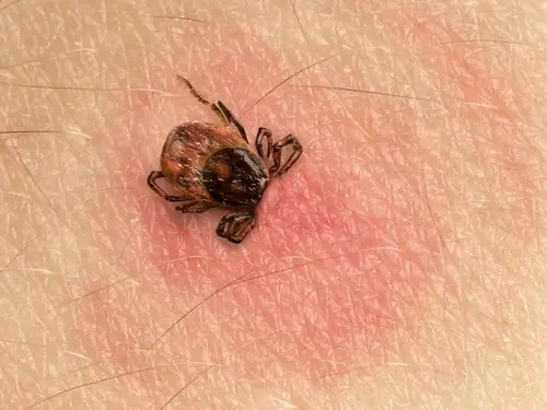Cosas que no sabias sobre las Garrapatas