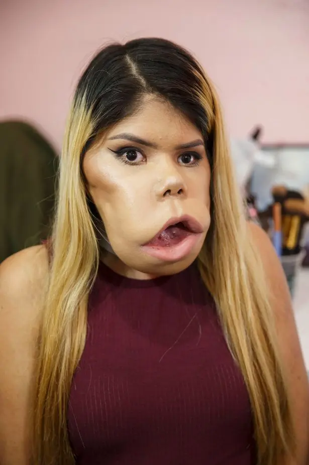 Marimar Quiroa la vloguera, te cuento qué padece.