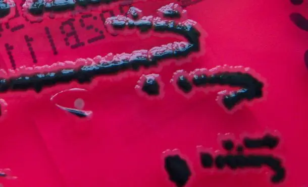 La bacteria que mata a sus “hijos” para continuar el ataque