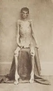 campo de prisioneros