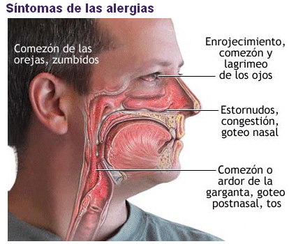 ojos rojos