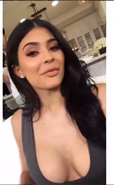Kylie Jenner se operó las bochas (apto)