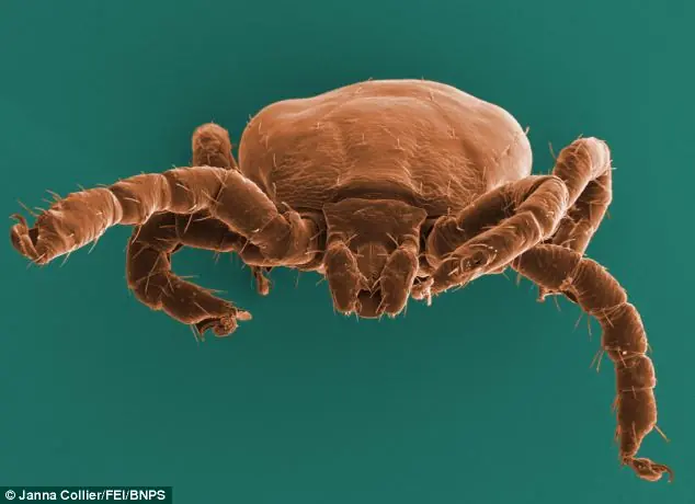18 Cosas que desearías NO haber visto bajo un microscopio
