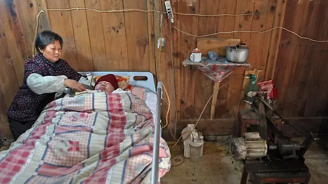 coma