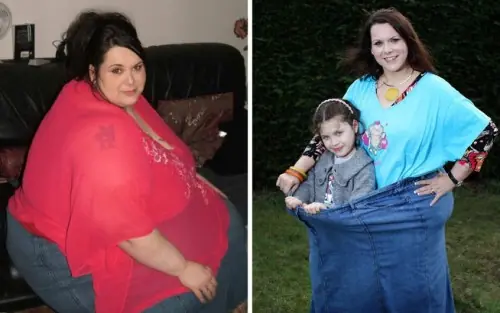 El síndrome de la gorda adelgazada