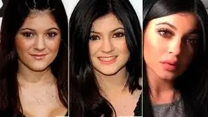 antes y despues