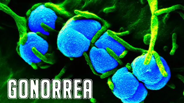prevencion