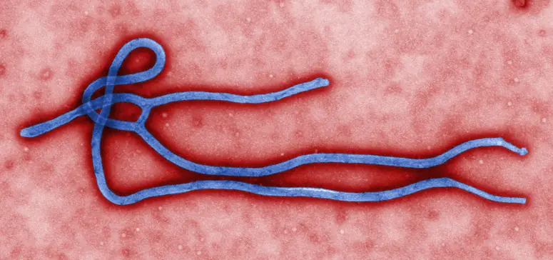 5 epidemias que podrían ocurrir en los próximos años