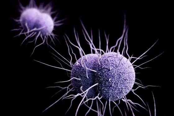 Neisseria gonorrhoeae