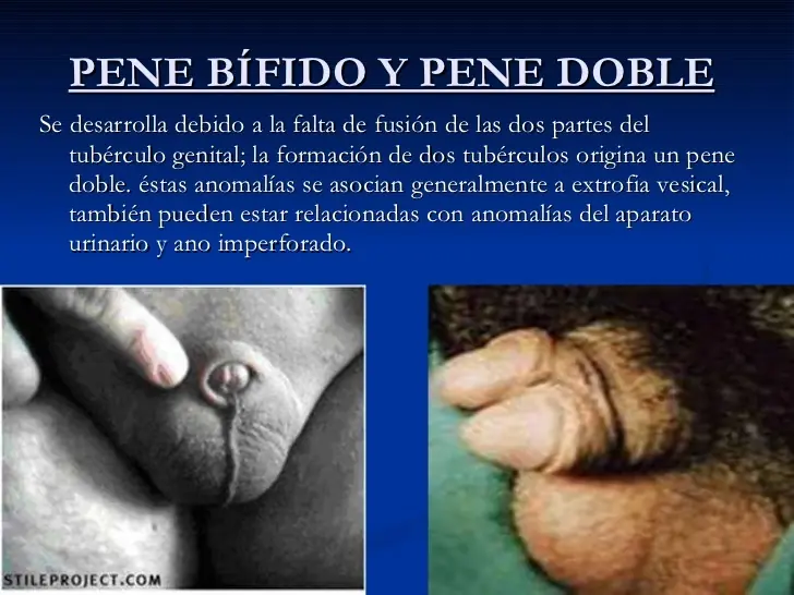 Cambios del pene