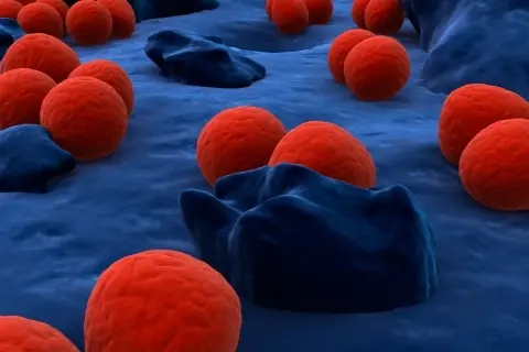 gonorrea