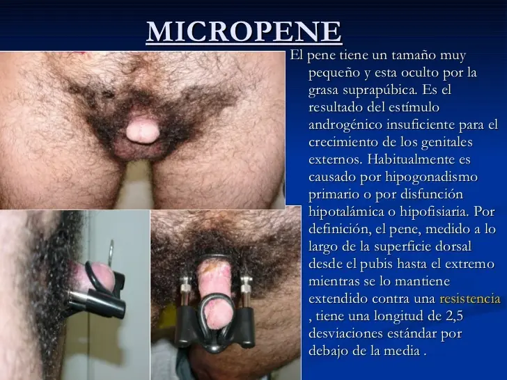medicina