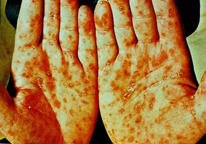 Experimentos macabros que se realizaron en humanos