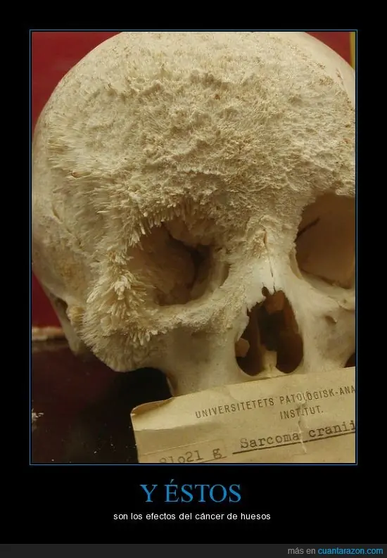celulas