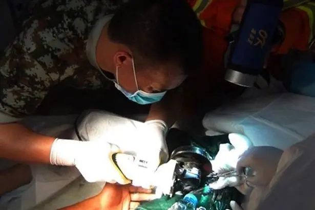 Le queda atrapado el pene en la manguera de desagüe del aire