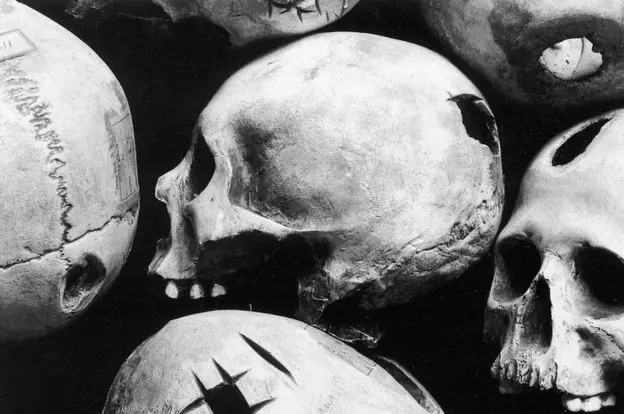 Trepanación: por qué los antepasados se perforaban el cráneo
