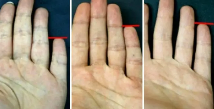Es lo que puede contar sobre ti tu dedo meñique