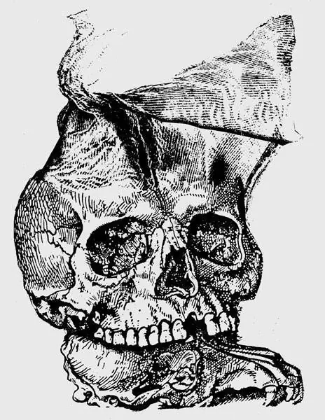 Aníbal Cedrón arte Argentino