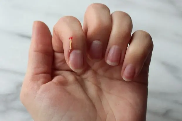 10 usos del hielo que probablemente no conocías 10 usos del hielo que probablemente no conocías